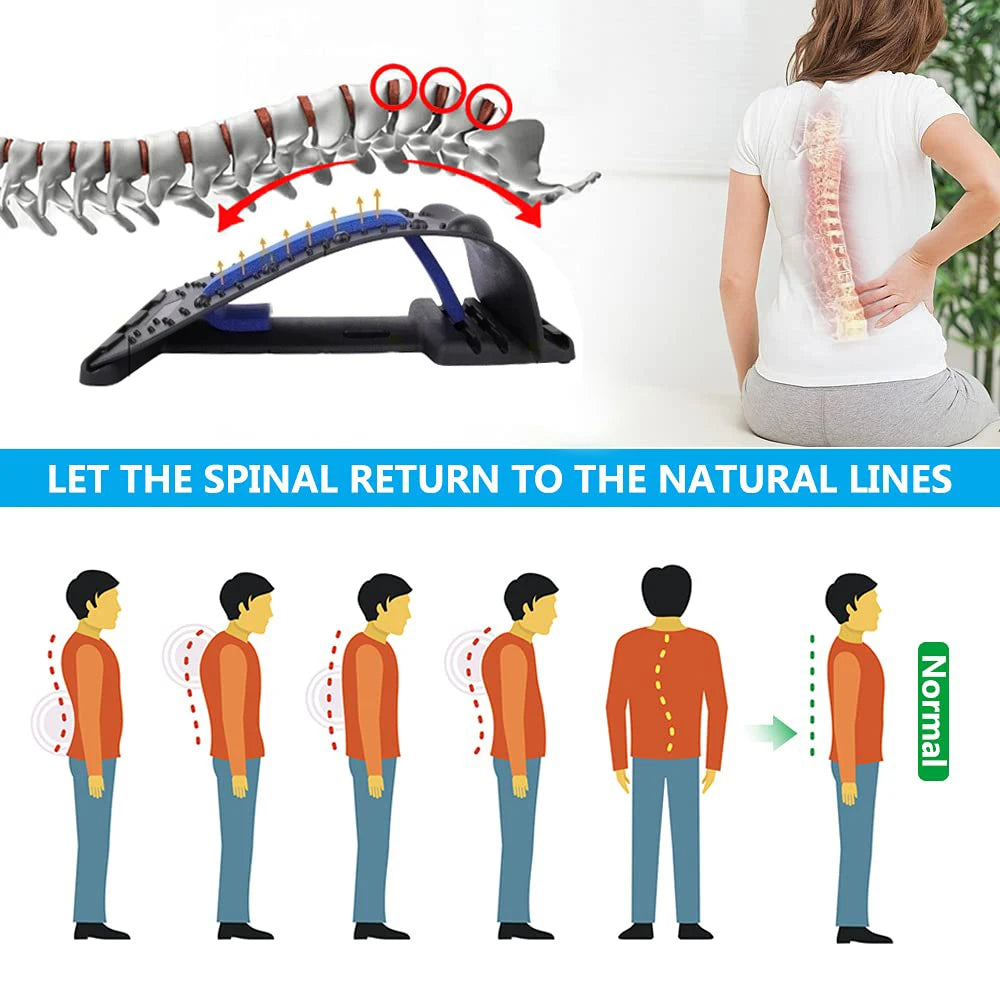 4-Level Adjustable Back Stretcher